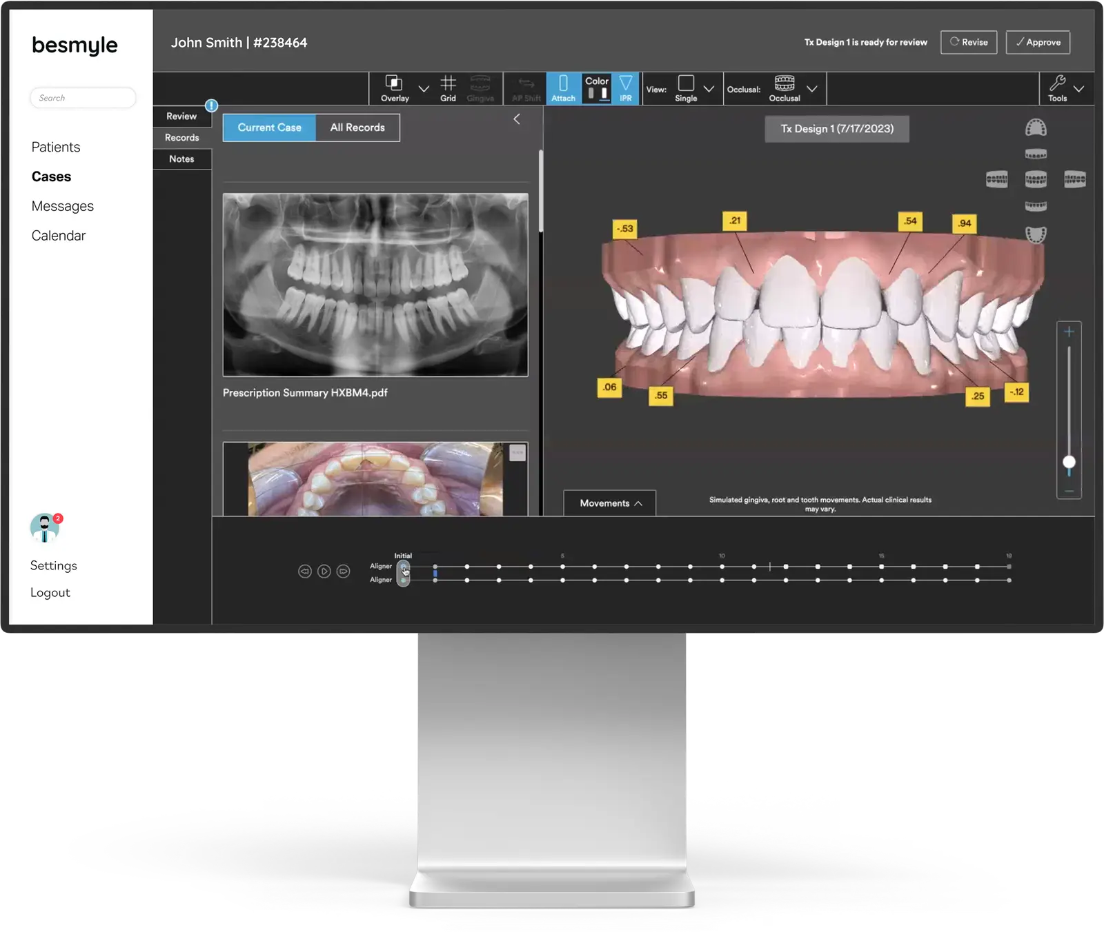 Image of a monitor running the besmyle portal software